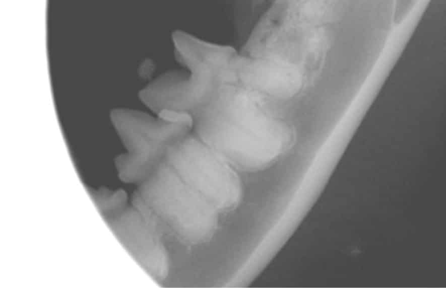 Dental X-ray showing a side view of teeth and jawbone structure.