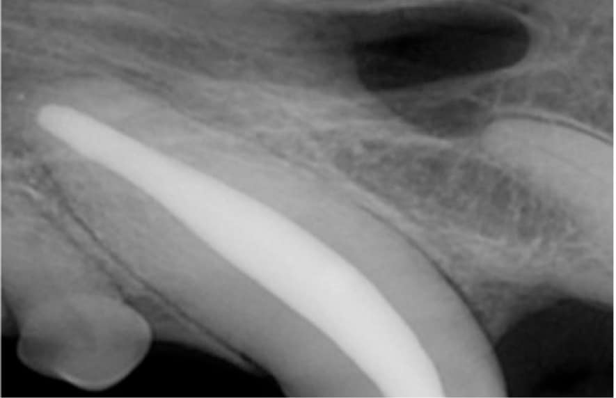 An X-ray image showing a contrast-filled urethra, highlighting its shape and position within the surrounding tissue.