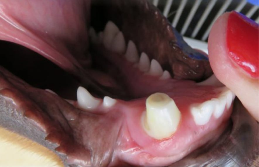 Close-up of a person's open mouth showing a canine tooth with a dental implant post on the gum.