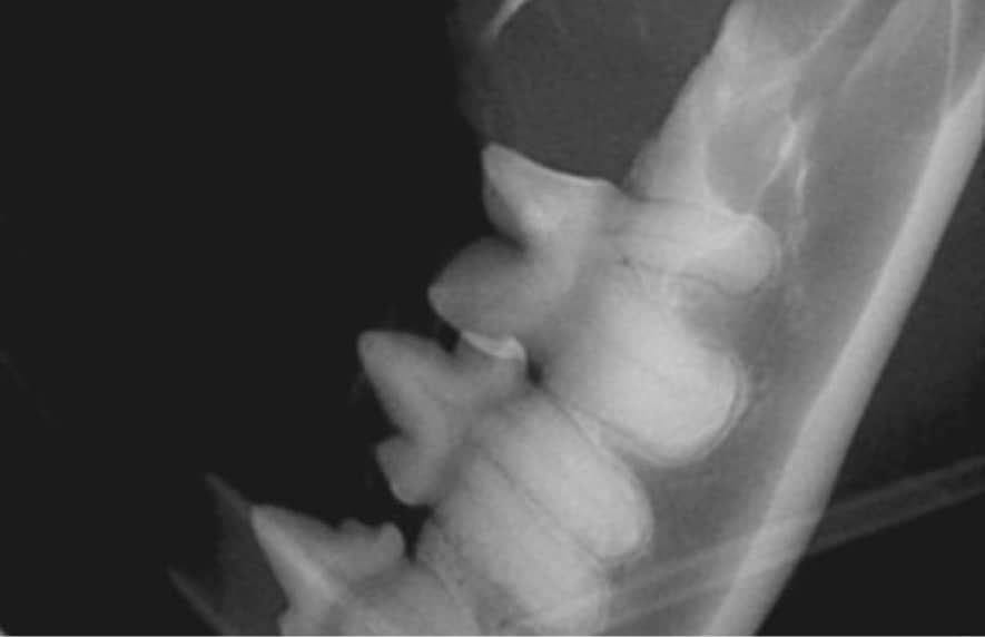 X-ray image showing a side view of a human neck with vertebrae visible.