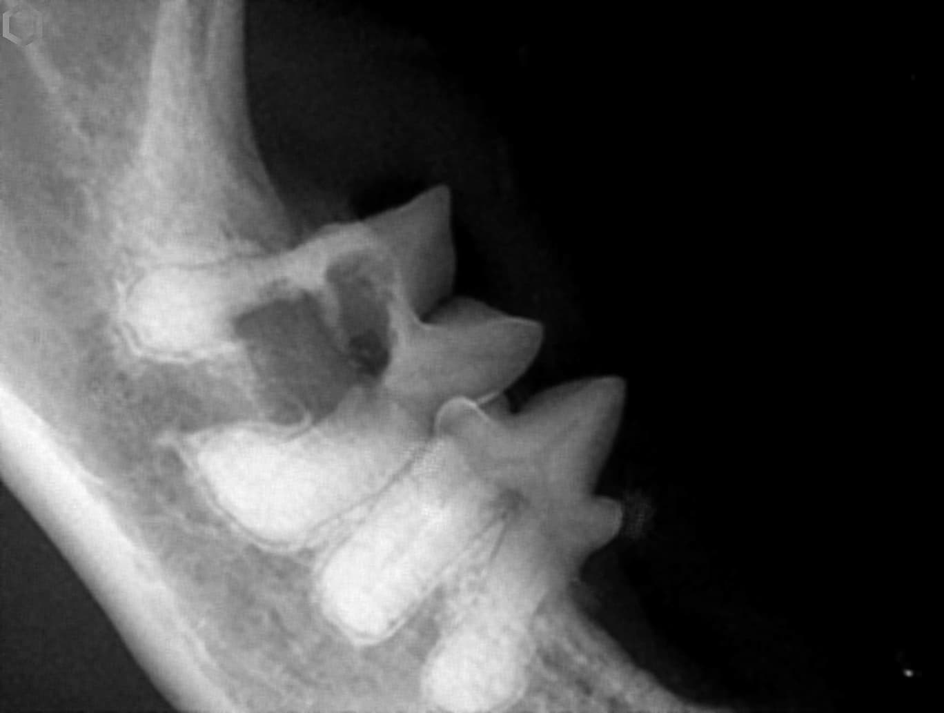 X-ray image of a human spine showing vertebrae in lateral view.